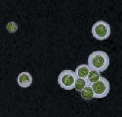 抜群の育毛成分「プレクラン」